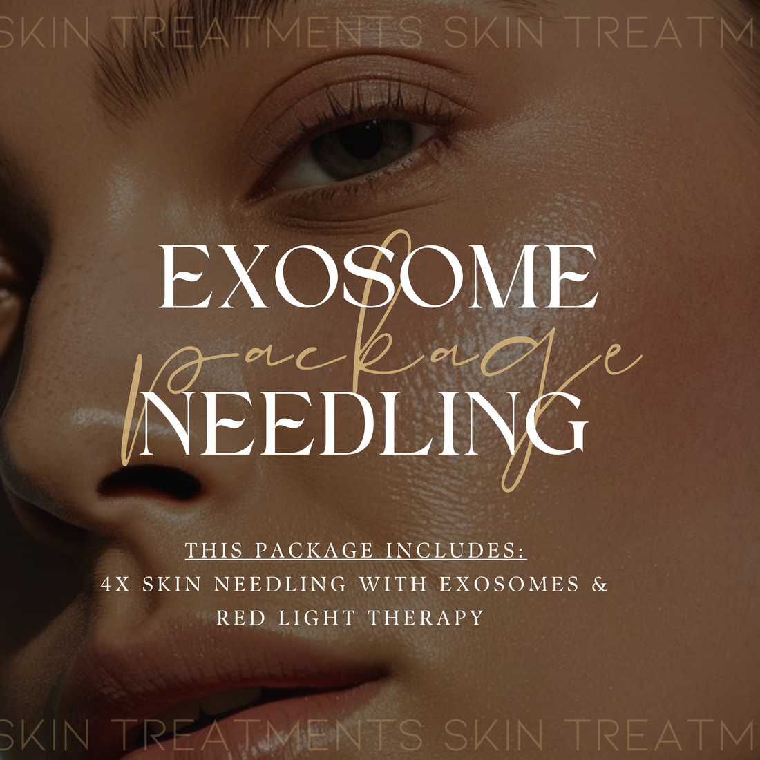 EXOSOME SKIN NEEDLING